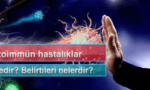 otoimmun hastalıklar